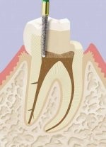 Endodontologie